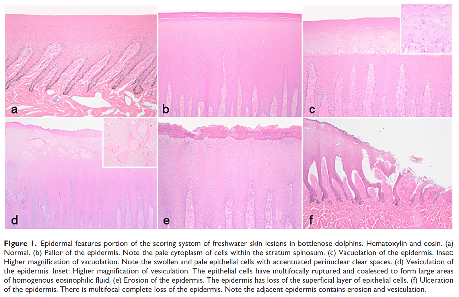 Figure 1 from the article depicting histopathology images of the epidermal features portion of the scoring system of freshwater skin lesions in bottlenose dolphins